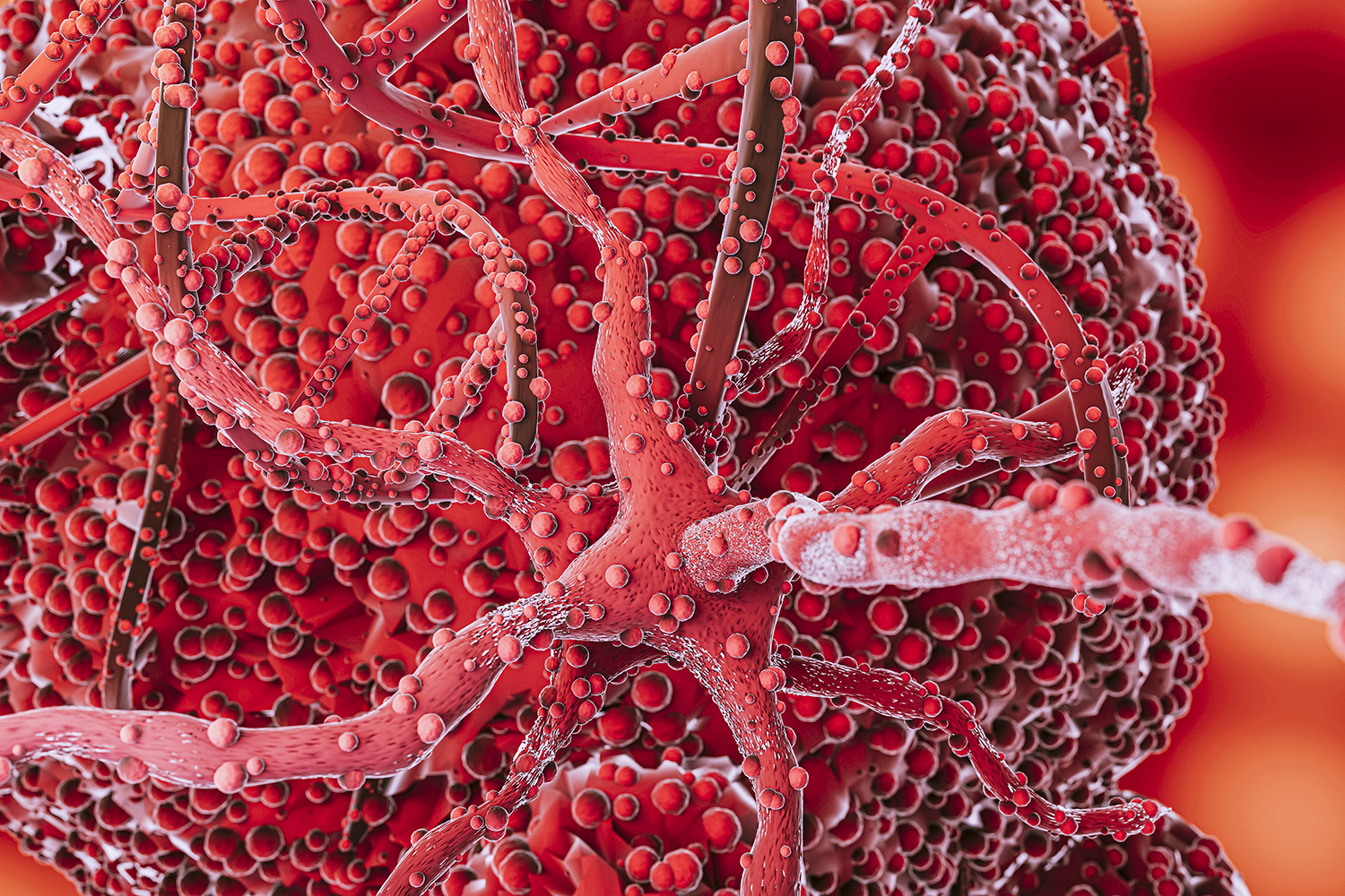 ENSAYO LIDERADO POR LA CLEVELAND CLINIC ENCUENTRA QUE UN NUEVO MEDICAMENTO PUEDE REDUCIR LA LIPOPROTEÍNA, UN IMPORTANTE FACTOR DE RIESGO DE ENFERMEDADES CARDÍACAS, EN MÁS DEL 80%.